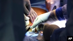 Surgeons perform the world’s first genetically modified pig kidney transplant into a living human, at Massachusetts General Hospital, in Boston, March 16, 2024. (Massachusetts General Hospital via AP)