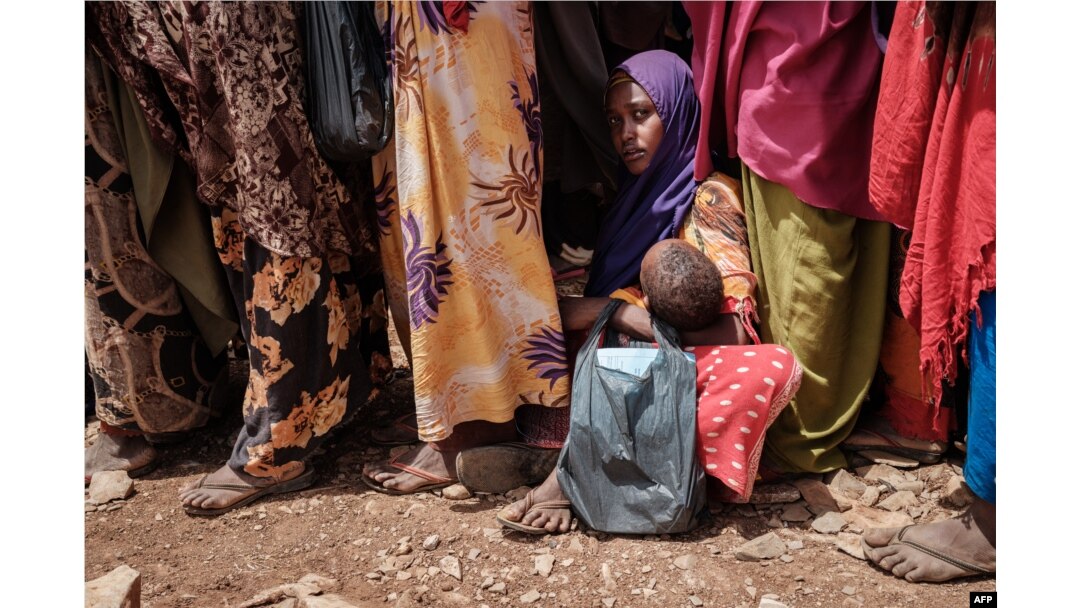 FILE - A woman holds her child as she waits for high nutrition foods and medical consultations at Tawkal 2 Dinsoor camp for internally displaced persons (IDPs) in Baidoa, Somalia, Feb. 14, 2022.