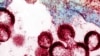 Scientists Disarm AIDS Virus’ Attack on Immune System