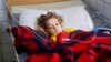 Surgeons are struggling to save the leg of three-year-old Noor after an airstrike injured her two weeks ago as the Mosul offensive started. “I want to see it, I want to see what happened to me,” she told her aunt. (J. Dettmer/VOA)
