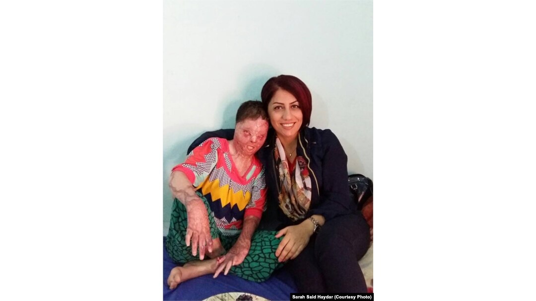 Sarah Said Haydar, left, shown here with a Yazidi activist, suffered burns over more than half her body in a suicide attempt.