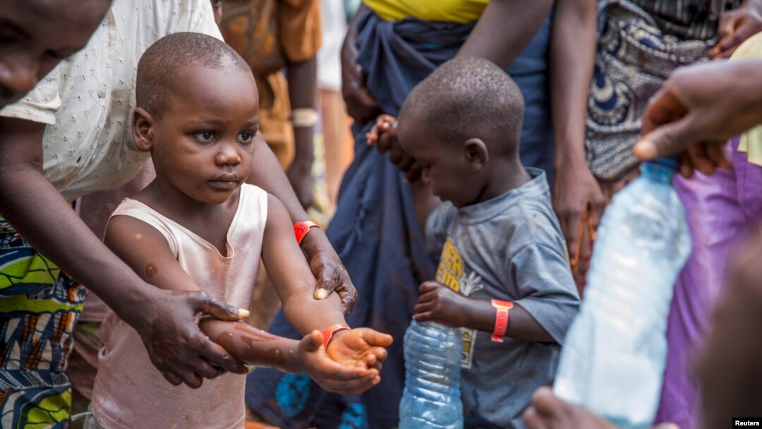 FILE - A refugee boy from Burundi who fled violence and political tension washes his hands at the Nyarugusu refugee camp in western Tanzania.