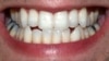 Healthy teeth and gums can help athletic performance