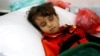 A girl infected with cholera rests at a hospital in Sanaa, Yemen, May 7, 2017.