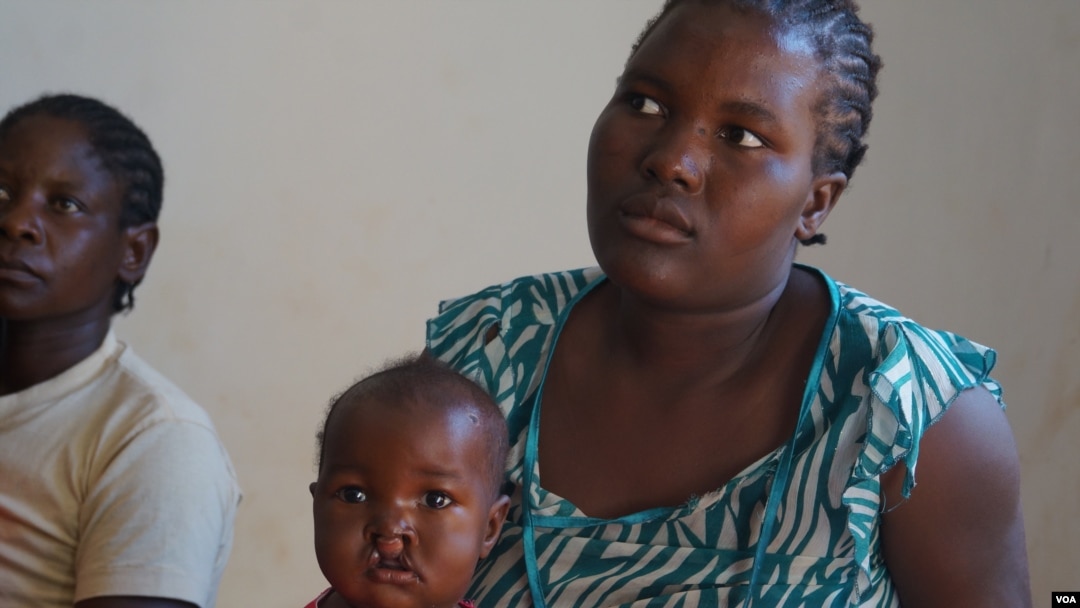 A mother waits for her child's turn to be operated on by the Operation Smile surgeons at Zomba Central Hospital in Malawi. (VOA/L. Masina)