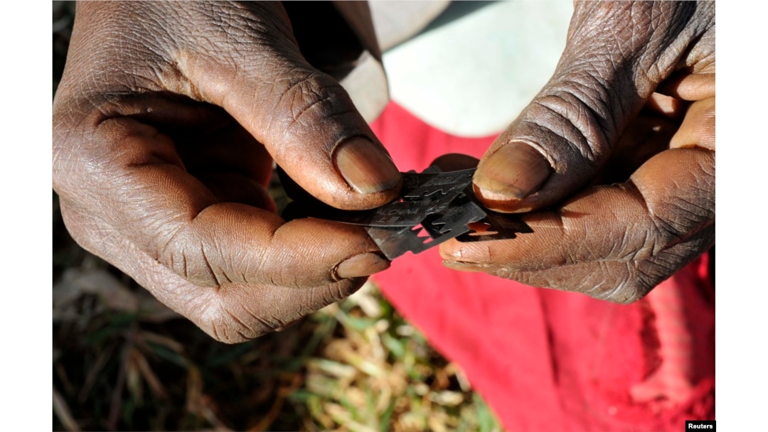 FILE - А traditional surgeon is seen holding razor blades used to carry out female circumcision, also known as female genital mutilation.