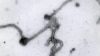 Ebola virus viewed through an electron microscope. The World Health Organization on Friday, Aug. 8, 2014 declared the Ebola outbreak in West Africa.